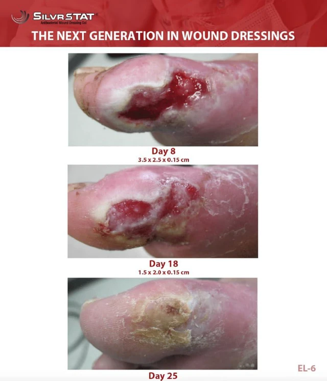 Alt view image 3 of 7 - First Aid Kit Gel, 32 PPM Silver Healing Wound Dressing Gel, SilverSol AgO Particles, 1 oz (Pack of 2)