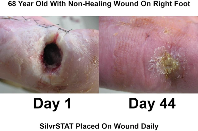 Alt view image 5 of 7 - First Aid Kit Gel, 32 PPM Silver Healing Wound Dressing Gel, SilverSol AgO Particles, 1 oz (Pack of 2)