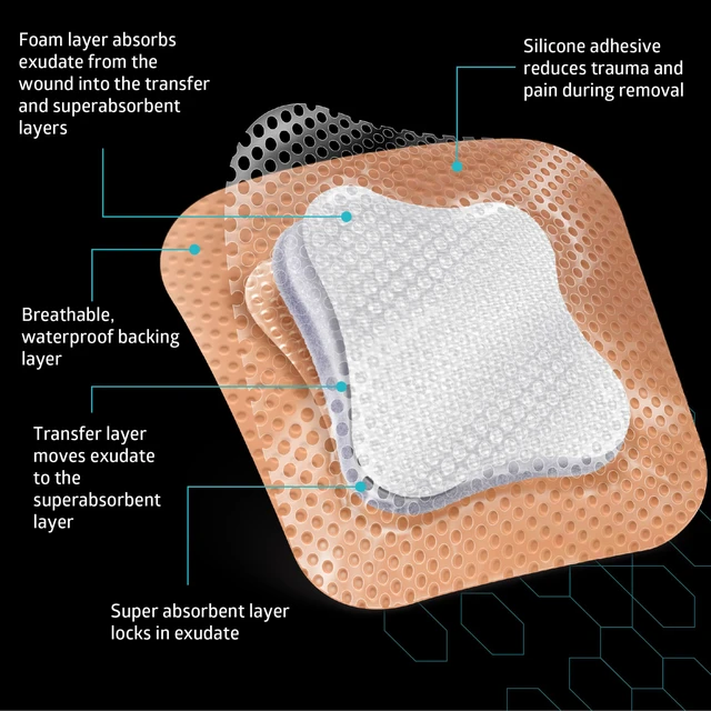 Alt view image 4 of 6 - Optifoam Gentle EX Silicone-Faced Bordered Foam Dressing, 4" x 4", 10 Count