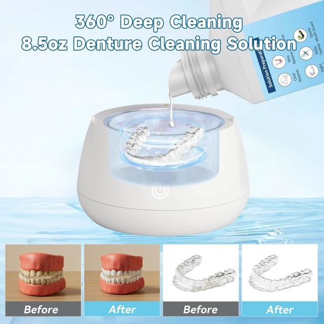 Alt view image 4 of 7 - Ultrasonic Retainer Cleaner Solution for Ultrasonic Denture Cleaner-Professional Cleaning of Retainers, Invisible Aligners, Mouth Guards, Night Guards, Remove Odors, Discoloration & Stains 32oz
