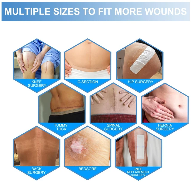 Alt view image 7 of 7 - 30 Pack 4"x12" Waterproof Adhesive Island Dressing for Post-Surgery Recovery | Sterile Bordered Gauze Bandages with Non-Stick Pad for Knee/Hip Replacement, Surgical Incision Care & Shower Protection