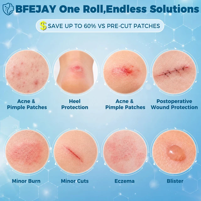 Alt view image 2 of 7 - Hydrocolloid Bandages for Wound Care, Medical-Grade Hydrocolloid Roll with Self-Adhesive, Ultra Absorbent, Flexible & Waterproof, Cut-to-Size First Aid Kit Essential (2in*16ft)