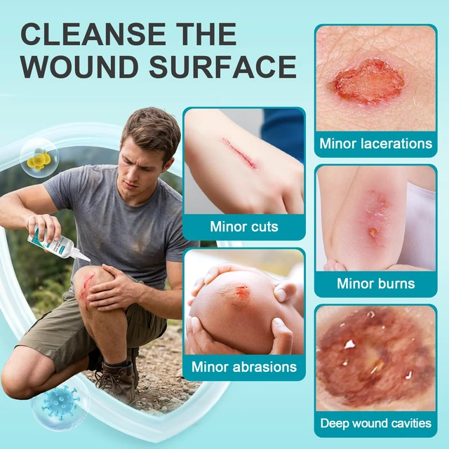 Alt view image 2 of 7 - Wound Cleanser Wash Solution Travel Size 60mL 3 Packs