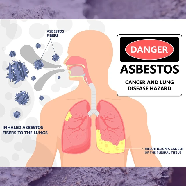 Alt view image 3 of 6 - Asbestos Test Kit - You Collect 2 Samples, We Analyze Them. Emailed Results Within 1 Week (5 Business Days) Includes Return Mailer and Expert Consultation. Lab Fee Included