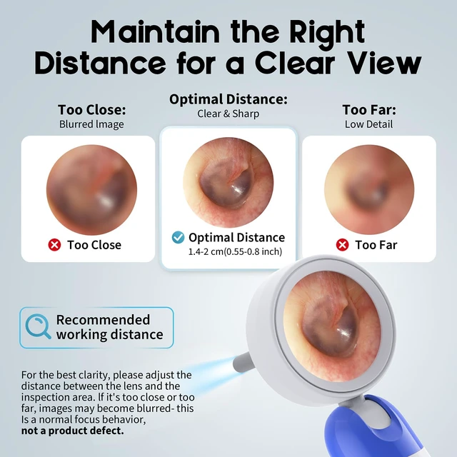 Alt view image 7 of 7 - 1080P HD Otoscope Ear Camera for Family, Medical Grade 1.38" Screen, Telemedicine Ready, 12 Silicone Tips, Photo/Video, Type-C Charging, Home MedicalBlue