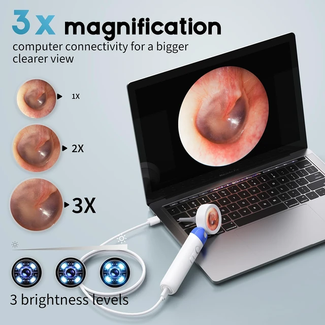 Alt view image 4 of 7 - 1080P HD Otoscope Ear Camera for Family, Medical Grade 1.38" Screen, Telemedicine Ready, 12 Silicone Tips, Photo/Video, Type-C Charging, Home MedicalBlue