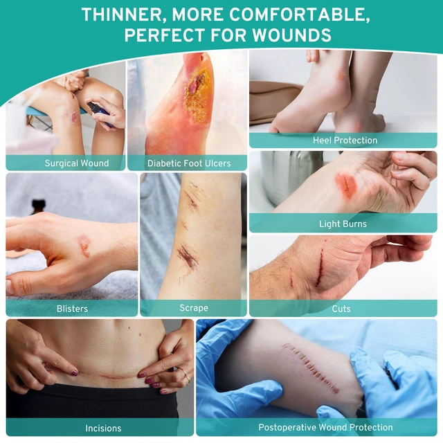Alt view image 3 of 7 - Hydrocolloid Roll for Wound Care Gentle Self-Adhesive 12FT Skin-Friendly Waterproof Hydrocolloid Bandages with Flexible Fit for Minor Wounds, Blisters, Pimples, and Friction