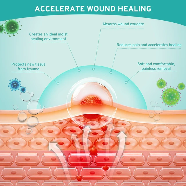 Alt view image 4 of 7 - Hydrocolloid Roll for Wound Care Gentle Self-Adhesive 12FT Skin-Friendly Waterproof Hydrocolloid Bandages with Flexible Fit for Minor Wounds, Blisters, Pimples, and Friction