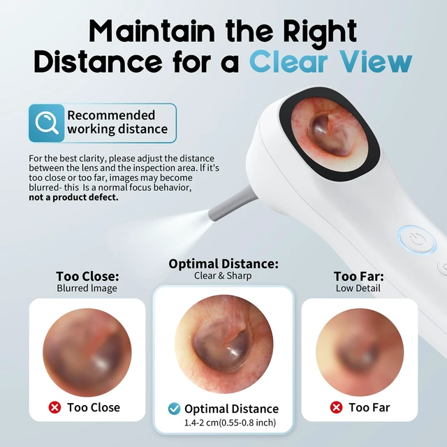 Alt view image 7 of 7 - Otoscope Ear Camera with 1.21 Screen, 1080P Ear Scope with 4 LED Lights, Otoscope Camera for Adults, Support Photo & Video, Type-C Charging with Computers, Baby Essentials, Home Medical