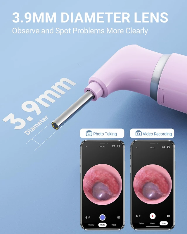Alt view image 2 of 7 - Otoscope with Light, Ear Camera with Dual View, 720pHD WiFi Ear Scope with 6 LED Lights, 3.9mm Lens Otoscope Camera for Kids and Adults, Ear Scope Compatible w/iPhone and Android Pink