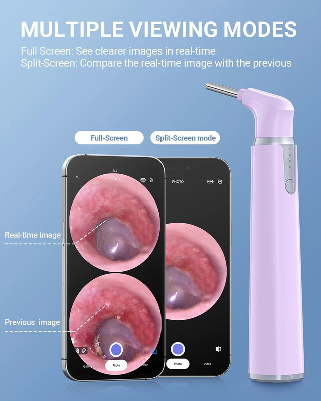 Alt view image 4 of 7 - Otoscope with Light, Ear Camera with Dual View, 720pHD WiFi Ear Scope with 6 LED Lights, 3.9mm Lens Otoscope Camera for Kids and Adults, Ear Scope Compatible w/iPhone and Android Pink