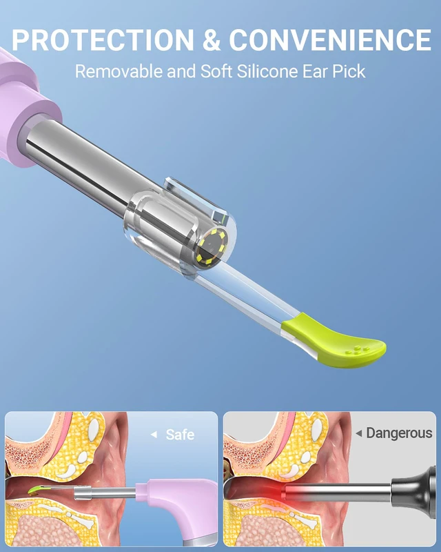 Alt view image 6 of 7 - Otoscope with Light, Ear Camera with Dual View, 720pHD WiFi Ear Scope with 6 LED Lights, 3.9mm Lens Otoscope Camera for Kids and Adults, Ear Scope Compatible w/iPhone and Android Pink