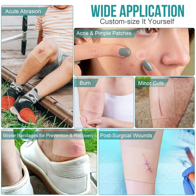 Alt view image 4 of 7 - 40 Pack Hydrocolloid Wound Dressing 4" x 4", Hydrocolloid Patch Bandages with Self-Adhesive, Bed Sore Bandages, Highly Absorbent for Burn, Blister, Acne Care, Sterile and Waterproof