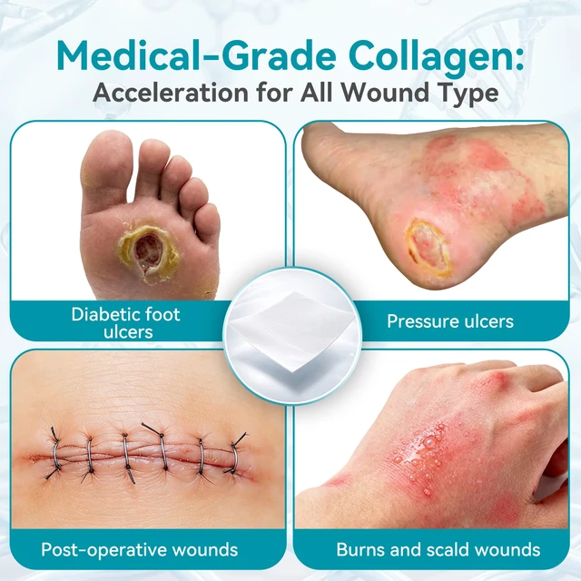 Alt view image 7 of 7 - Collagen Wound Dressing 2"X2" 5PCS 100% Bovine Type I Collagen Sponge, High Absorbency (4x Fluid), Biodegradable, For Chronic & Acute Wounds