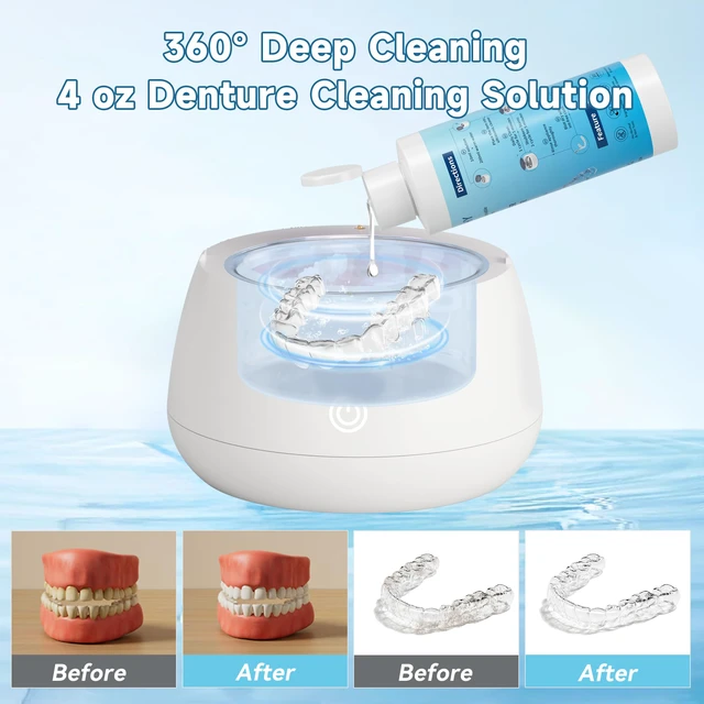 Alt view image 4 of 7 - Ultrasonic Retainer Cleaner Solution for Ultrasonic Denture Cleaner-Professional Cleaning of Retainers, Invisible Aligners, Mouth Guards, Night Guards, Remove Odors, Discoloration & Stains 4oz