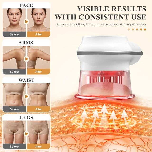 Alt view image 5 of 7 - Cellulite Massage Tool,Lymphatic Drainage Massager | Heat/Light/Suction/GuaSha, 5000mAh Cordless, Arms/Legs/Abdomen/Back, Firm/Relieve, Men/Women Gift White