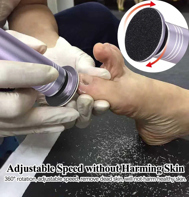 Alt view image 3 of 7 - Upgraded Electric Callus Remover for Feet 1200rpm, Adjustable Speed Professional Electric Foot Sander Foot Filer Women Men Pedicure Tools for Feet Callus Remover, FCR-2 Gray