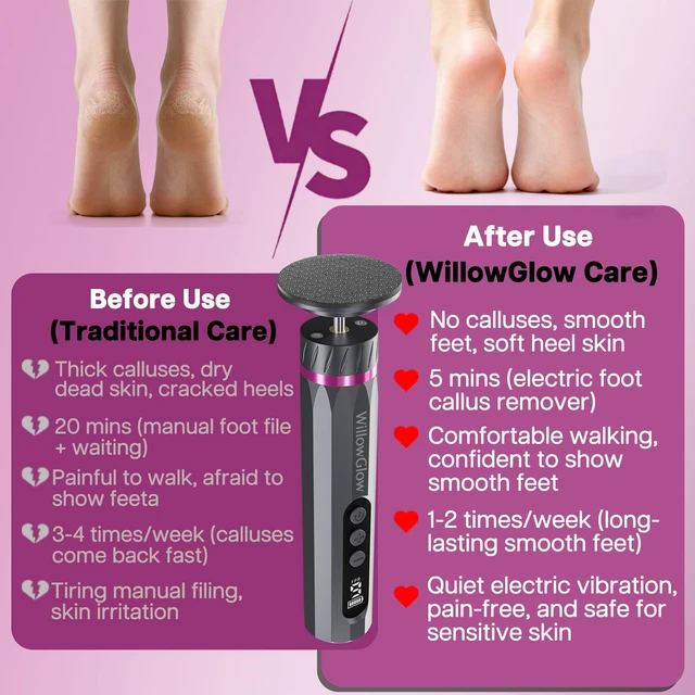 Alt view image 4 of 7 - Professional Electric Foot Callus Remover, 9-Speed Cordless Foot File with Reusable Nano Glass Heads & Sandpaper for Dead Skin Removal and Smooth Feet