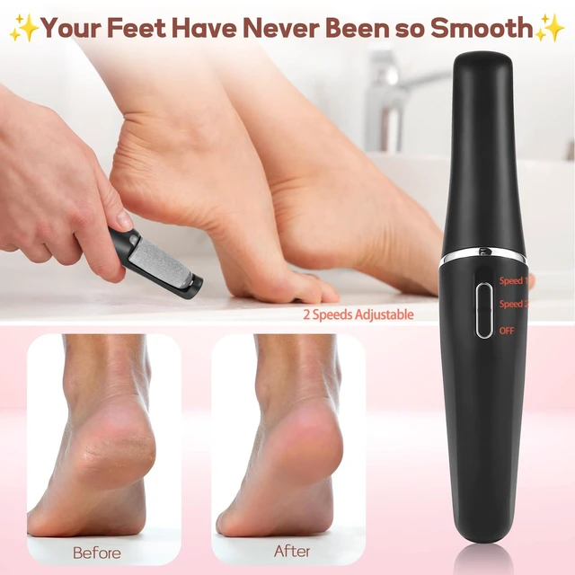 Alt view image 3 of 6 - Callus Remover for Feet, Electric Foot Filer, Pedicure Tools -Black | Rechargeable Foot Grinder, Removes Dry Hard & Dead Skin, Ideal Gift