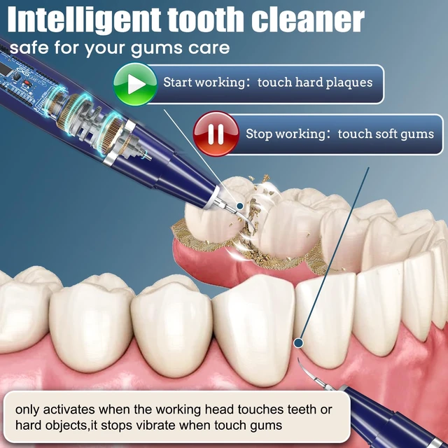 Alt view image 3 of 5 - Plaque Remover for Teeth - Tartar Remover for Teeth, Dental Calculus Remover Teeth Cleaning Kit