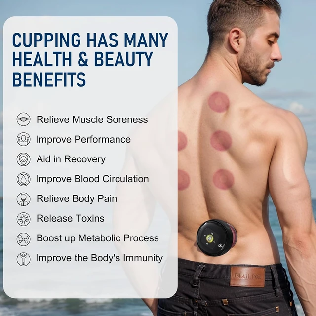 Alt view image 2 of 7 - 5-in-1 Smart Dynamic Cupping Set, 12 Levels Cupping Kit for Massage Therapy with Heat Penetrates for Targeted Pain Relief, Knots, Aches, Muscle Soreness - Black