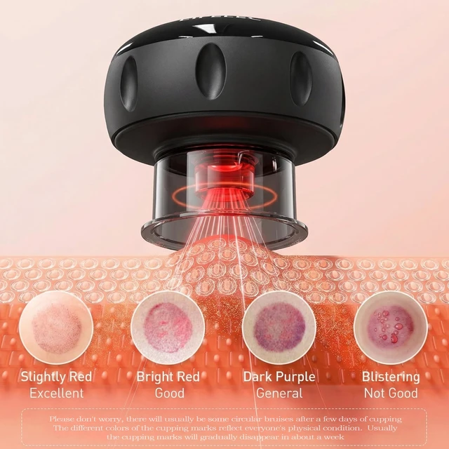 Alt view image 7 of 7 - 2PCS Electric Cupping Therapy Set - 6 Cups (Large/Press/Move) | 12-Level Heat & Suction, Smart Red Light Therapy, Dual Massagers for Simultaneous Use, For Athletes, Fitness, Pain Relief