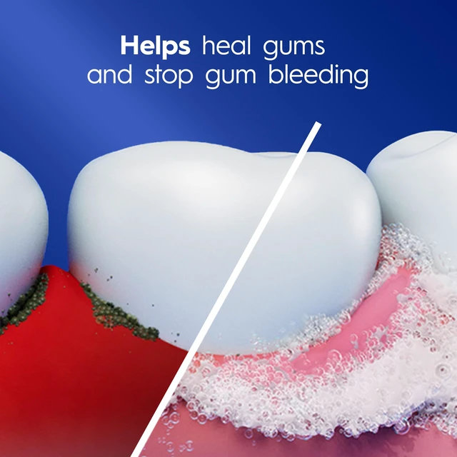 Alt view image 4 of 7 - Pro-Health Gum Detoxify Deep Clean Toothpaste 4.8 oz - Anticavity, Antibacterial Flouride Toothpaste, Clinically Proven, Gum and Enamel Protection, Plaque Control