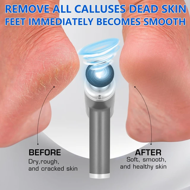 Alt view image 11 of 14 - Upgraded Electric Callus Remover for Feet 4500rpm, Professional Electric Foot Callus Remover Foot Sander Pedicure File with 2 Interchangeable Heads and Replaceable Sandpaper Discs