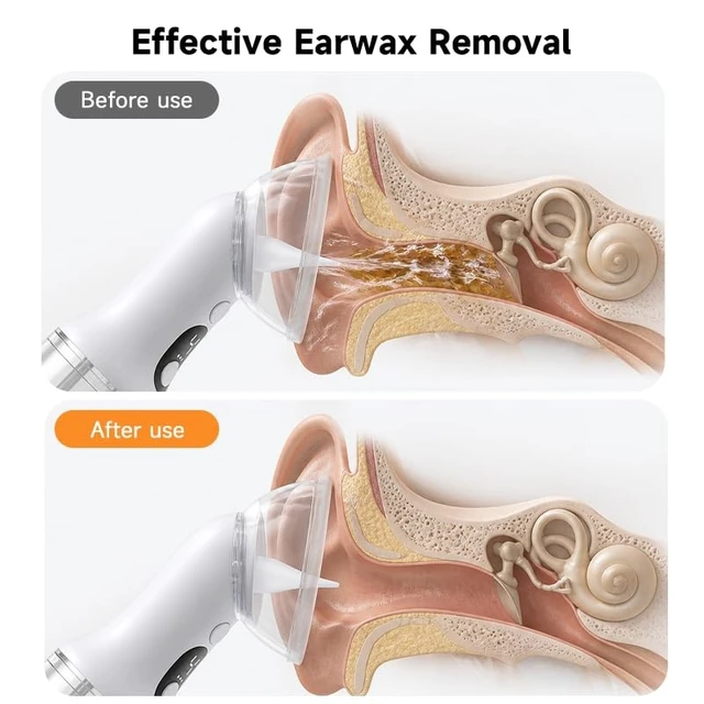 Alt view image 14 of 14 - Electric Ear Wax Removal Kit - Safe & Gentle Waxy Ear Cleaner Tool with 4 Pressure Settings, LED Display, IPX7 Waterproof & Dual-Chamber Design for Upgraded Ear Irrigation and Personal Ear Care