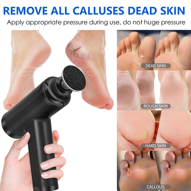Alt view image 12 of 14 - Upgraded Electric Callus Remover for Feet 4500rpm, Adjustable Speed Professional Electric Foot Sander Grinder Foot File for Calloused Feet Dead Hard Cracked Skin, with 4 Interchangeable Heads (Black)