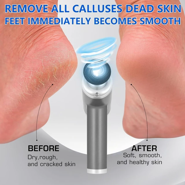 Alt view image 4 of 7 - Upgraded Electric Callus Remover for Feet 4500rpm, Professional Electric Foot Callus Remover Foot Sander Pedicure File with 2 Interchangeable Heads and Replaceable Sandpaper Discs