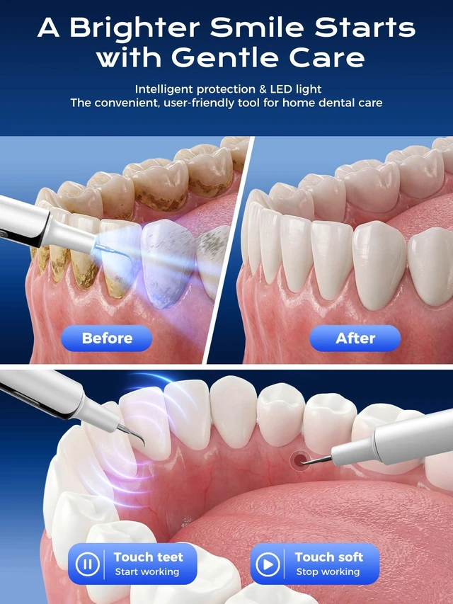 Alt view image 9 of 14 - Ultrasonic Plaque Remover for Teeth - 42kHz Tartar Remover with Sensor Gum Protection, Memory & 10-Min Auto Shutoff, IPX6 Waterproof, USB-C Rechargeable Dental Tools for Sensitive Teeth