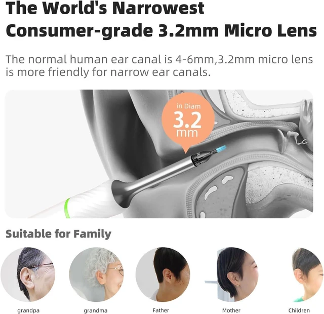 Alt view image 12 of 14 - Bebird Pro Note5 Ear Picker with Camera Tweezers, Wireless Wax Removal Tool Camera Cleaner Otoscope with Light for iPhone, Visual Ear Viewing Scope with Videos, WiFi Cleaning Kit for Adults & Kids