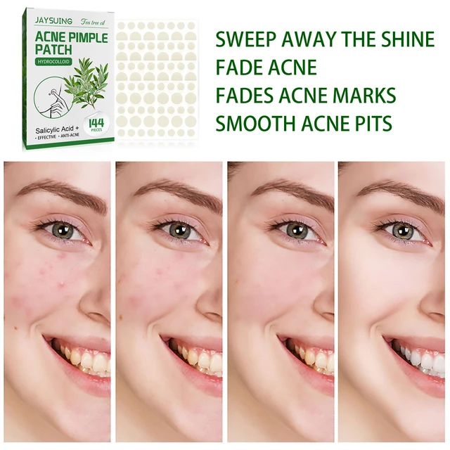 Alt view image 3 of 6 - Invisible Waterproof Acne Pimple Patch for Skin Lightening and Anti-Acne Care