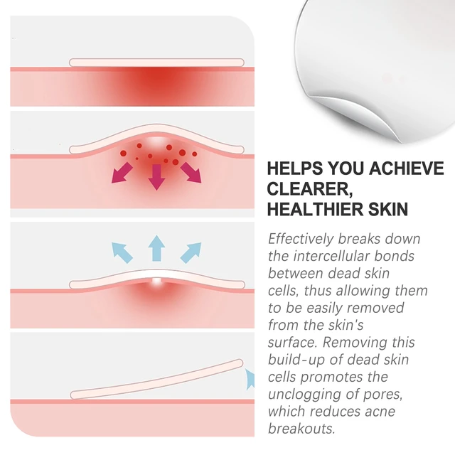 Alt view image 4 of 7 - West & Month Invisible Breathable Acne Patches for Spot Concealing and Skin Repair
