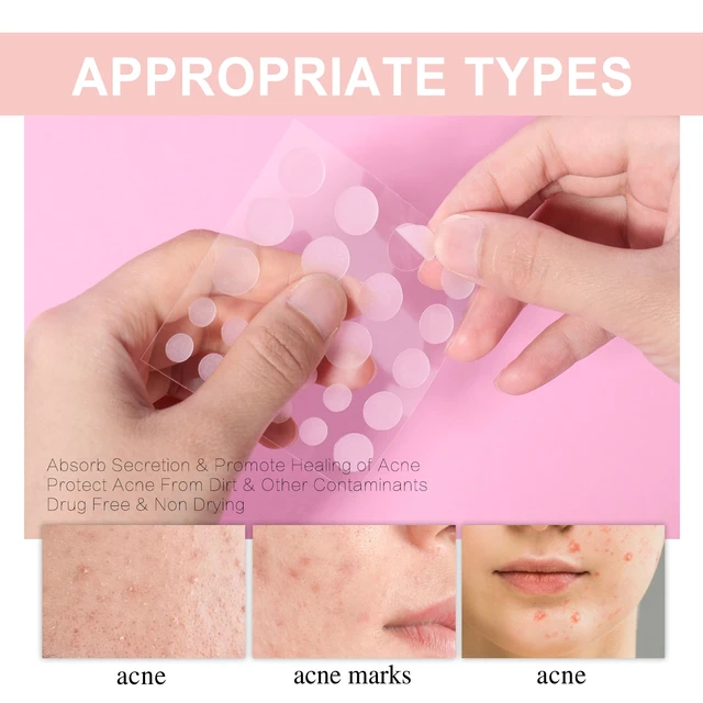 Alt view image 3 of 7 - West & Month Invisible Breathable Acne Patches for Spot Concealing and Skin Repair