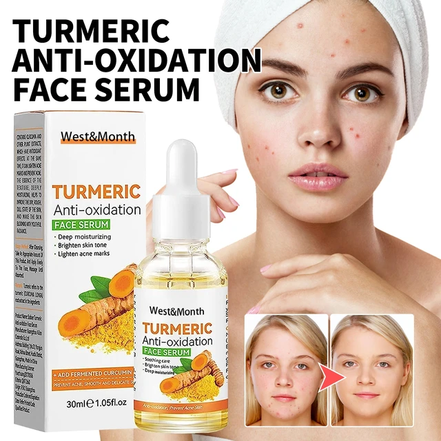 Alt view image 2 of 6 - Acne Mark Fading & Skin Brightening Essence, West & Month Turmeric Facial Toner for Spot Reduction