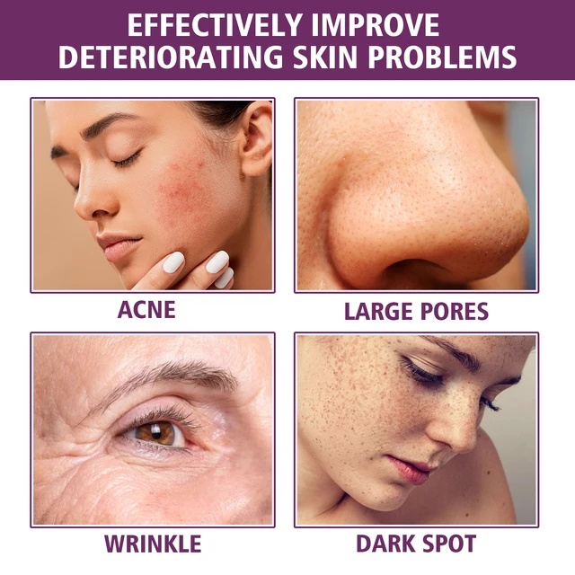 Alt view image 3 of 6 - Niacinamide Anti-Wrinkle Essence Serum for Skin Care