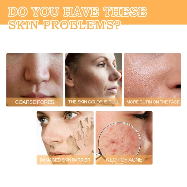 Alt view image 3 of 6 - Fading & Moisturizing Skin, 7% Glycolic Acid Toner for Acne Repair