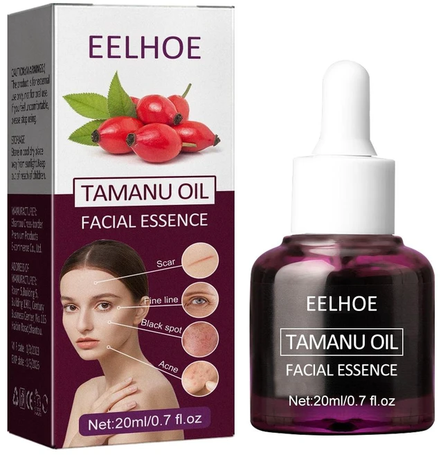 Main image of Hydrate & Firm Skin, Fade Acne Scars & Pores, Qiongya Begonia Noodle Oil - Desalinate