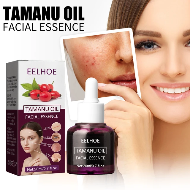 Alt view image 2 of 7 - Hydrate & Firm Skin, Fade Acne Scars & Pores, Qiongya Begonia Noodle Oil - Desalinate