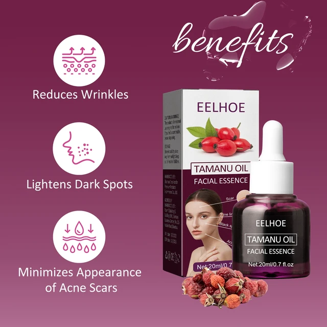 Alt view image 4 of 7 - Hydrate & Firm Skin, Fade Acne Scars & Pores, Qiongya Begonia Noodle Oil - Desalinate