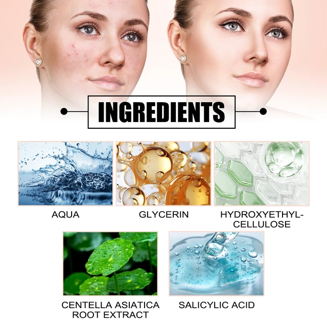 Alt view image 5 of 6 - West & Month Invisible Color-Shaped Acne Patches Portable Spot Treatment