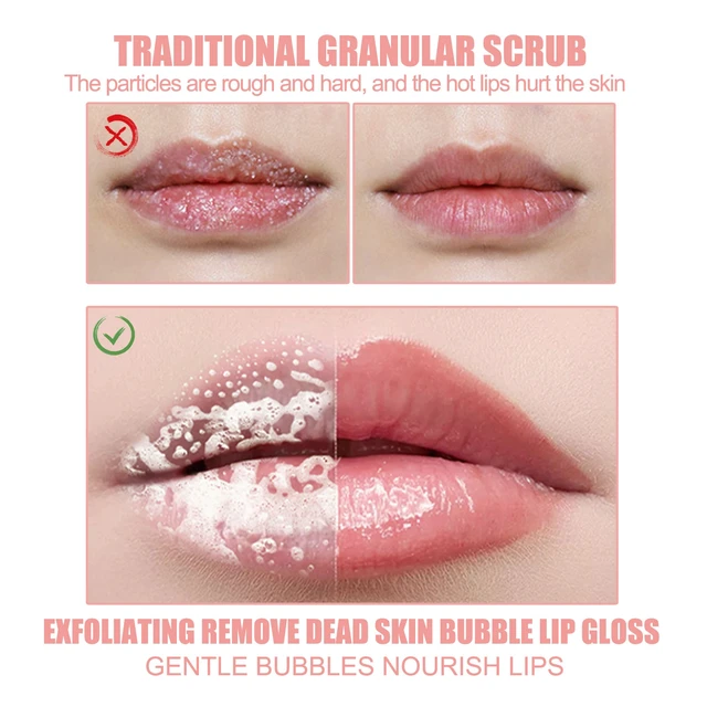 Alt view image 3 of 7 - Bubble Lip Peel Off Mask Exfoliating Dead Skin Removal Moisturizing Hydrating Anti-Chapping Softening Lip Care Film