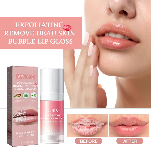 Alt view image 2 of 7 - Bubble Lip Peel Off Mask Exfoliating Dead Skin Removal Moisturizing Hydrating Anti-Chapping Softening Lip Care Film