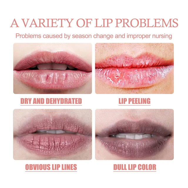 Alt view image 4 of 7 - Bubble Lip Peel Off Mask Exfoliating Dead Skin Removal Moisturizing Hydrating Anti-Chapping Softening Lip Care Film