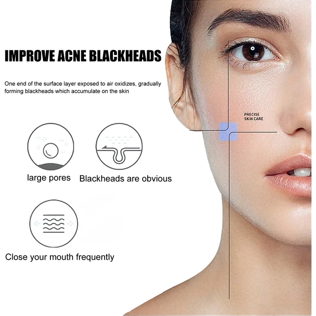 Alt view image 4 of 7 - Deep Cleansing Nose Strip for Blackhead and Acne Removal - Peel Off Pore Refining Mask