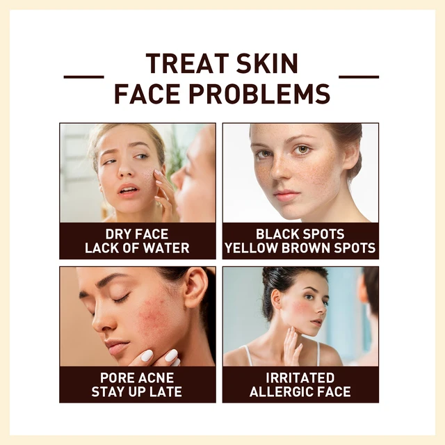 Alt view image 3 of 6 - Firming & Brightening Essence, Hydrating, Skin Repairing, Rice Extract Anti-Wrinkle Serum