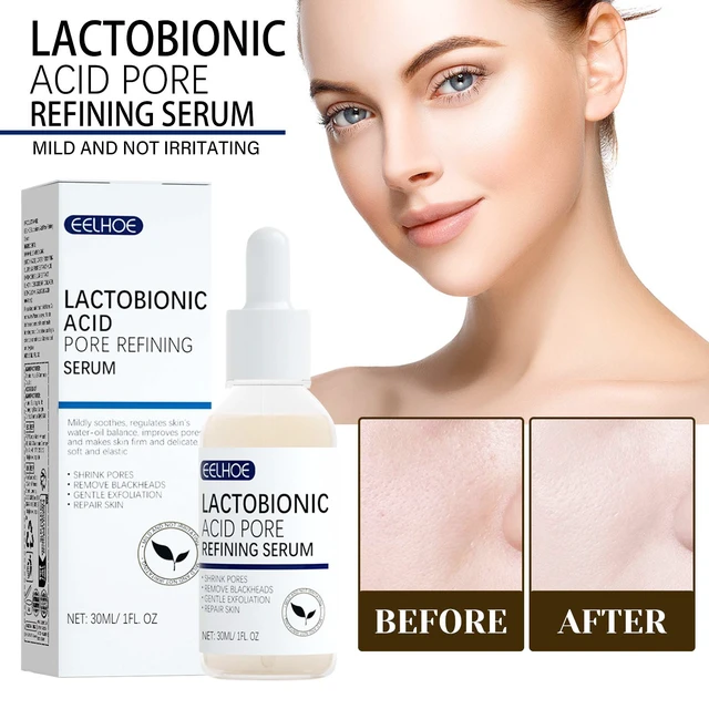 Alt view image 2 of 6 - Cleansing Blackheads and Acne, Lactobionic Acid Facial Essence for Elastic & Fine Skin Care