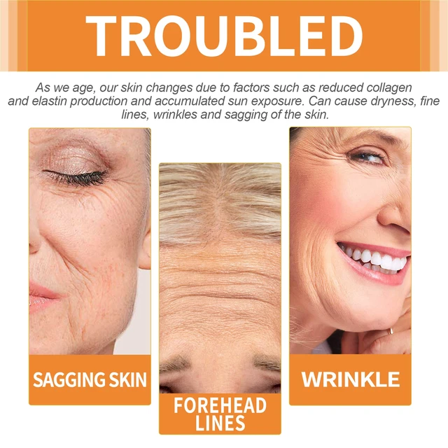 Alt view image 4 of 6 - Water-Soluble Collagen Forehead Lifting Film Patch for Skin Tightening and Anti-Wrinkle Care